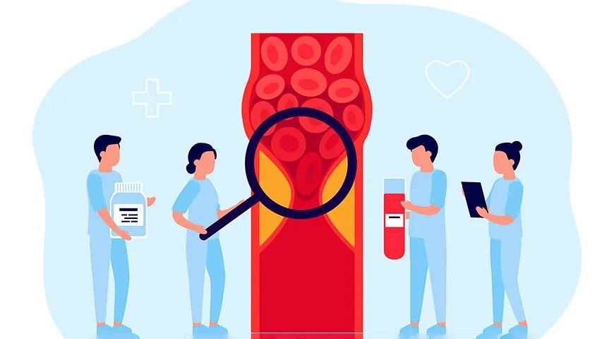 Как правильно питаться при атеросклерозе: советы и рекомендации