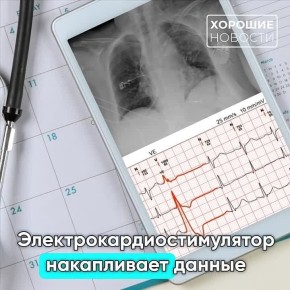 «Ростех» начал серийное производство первого российского МРТ-совместимого электрокардиостимулятора Apollo MRI