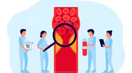 ��� ��������� �������� ��� �������������: ������ � ������������