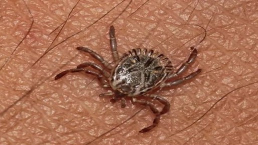 Как защититься от клещей на природе: практические советы