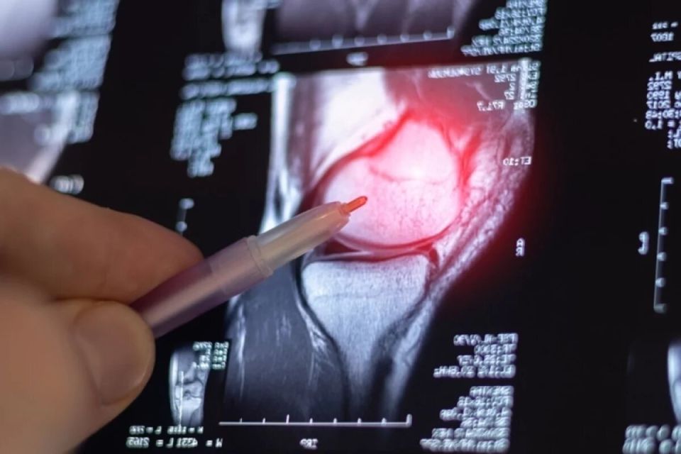 Как напитки влияют на суставы: что полезно пить для подвижности и комфорта